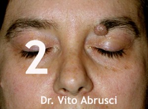foto-2