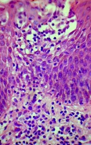 Fig. 3: Histopatología H-E (400x)