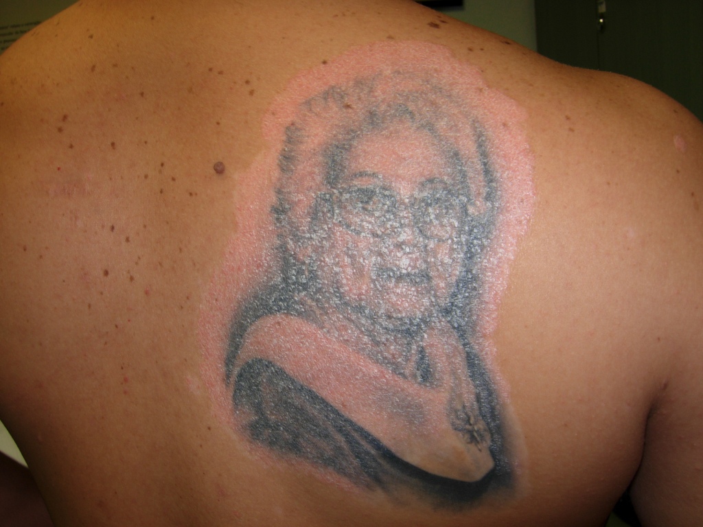 Dermatología descarta que la tinta de los tatuajes provoque cáncer de piel