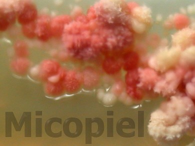 Fig. 21: 18 días de incubación en agar Agua de Coco a 37ºC, detalle de la colonia