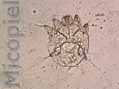 Fig. 9: Las larvas de 3 a 8 días se transforman en ninfas de Sarcoptes scabiei var. hominis que se puede confirmar por sus 3 pares de patas