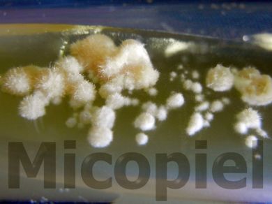 Fig. 8: Cultivo en agar coco, 30 días de incubación a temperatura ambiente, colonias compatibles de Paracoccidioides brasiliensis