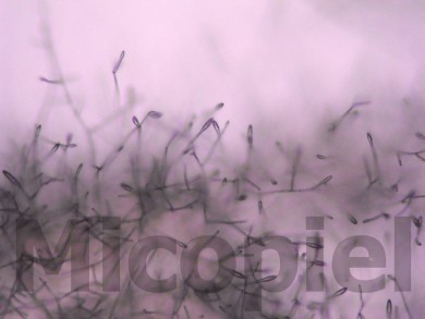 Fig. 11: Microfotografía directa del cultivo en el cual se aprecian los aleuroconidios característicos del genero Microsporum (100x)