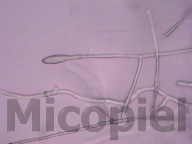 Fig. 12: Detalle de un aleuroconidio característico del genero Microsporum (1000x)