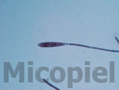 Fig. 13: Detalle del aleuroconidio teñido con solución de Negro Amido el cual confirma el dermatofito Microsporum gypseum por presentar hasta 6 lóculos o septos (1000x)