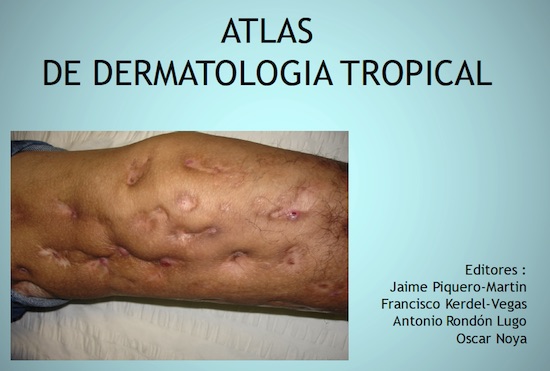 atlas-derma-tropical