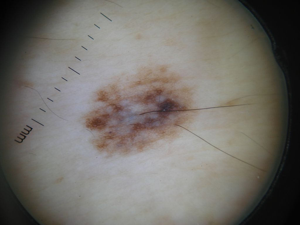 Dermatoscopia Edición 253 – PIEL-L Latinoamericana