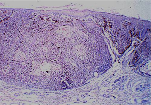 Dermatoscopia Edición 262 – PIEL-L Latinoamericana
