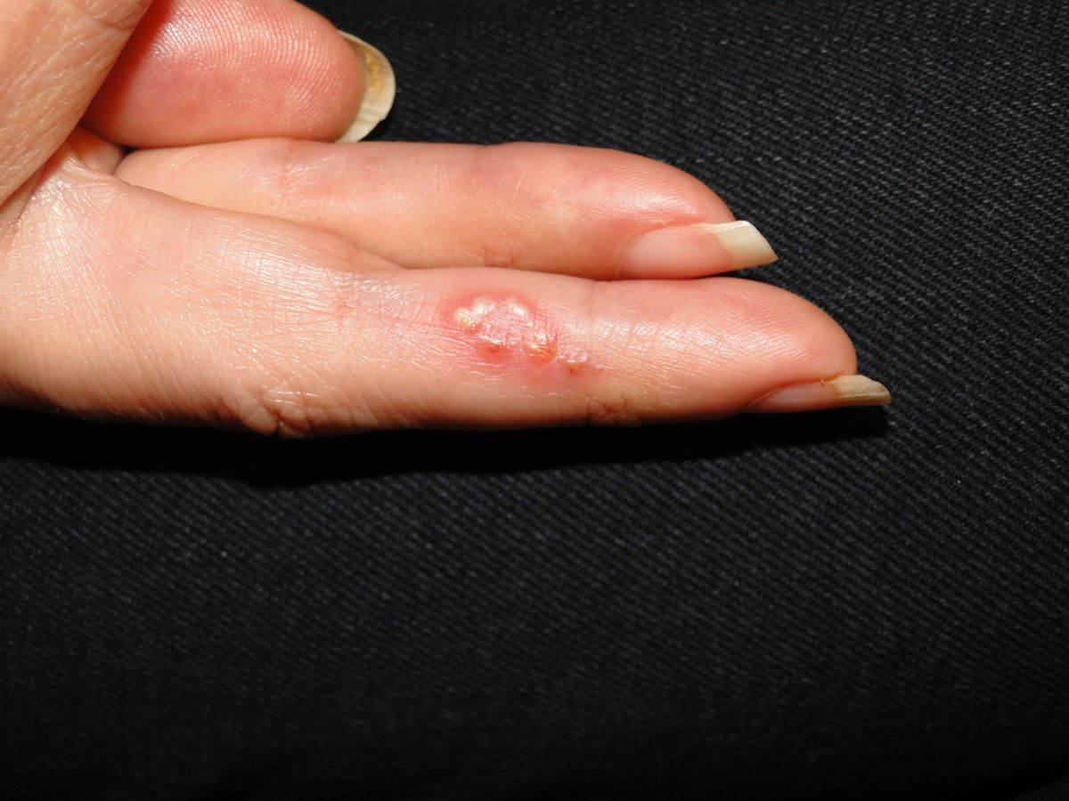 CloseUp Nº 402 PIELL Latinoamericana