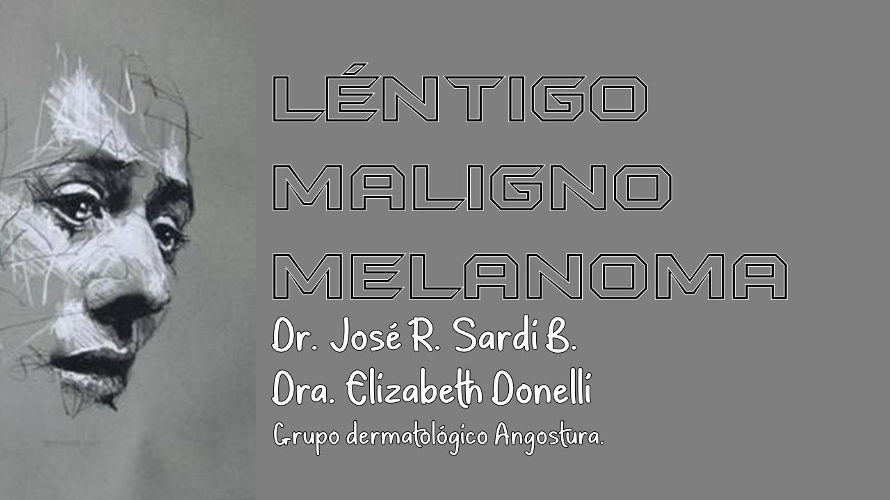 Léntigo Maligno Melanoma – Piel L Latinoamericana