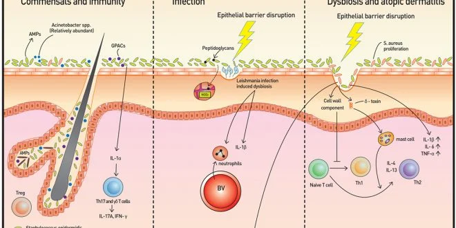 Skin-microbiota-Figure-from-Frontiers-660x330